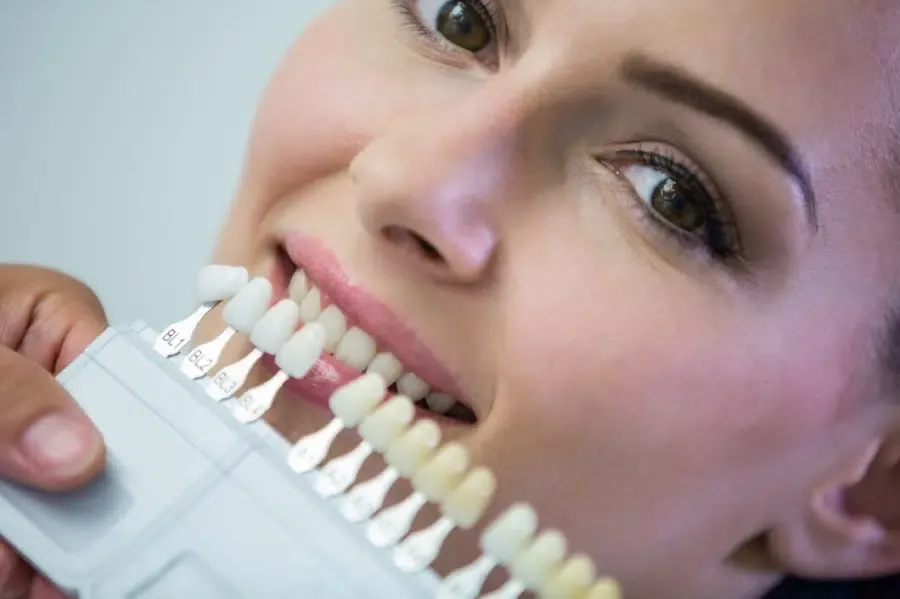 Porcelain veneer shade matching at VIP Dental Clinic Miranda